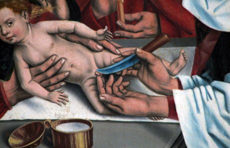 מדוע אנחנו חותכים עורלת תינוק