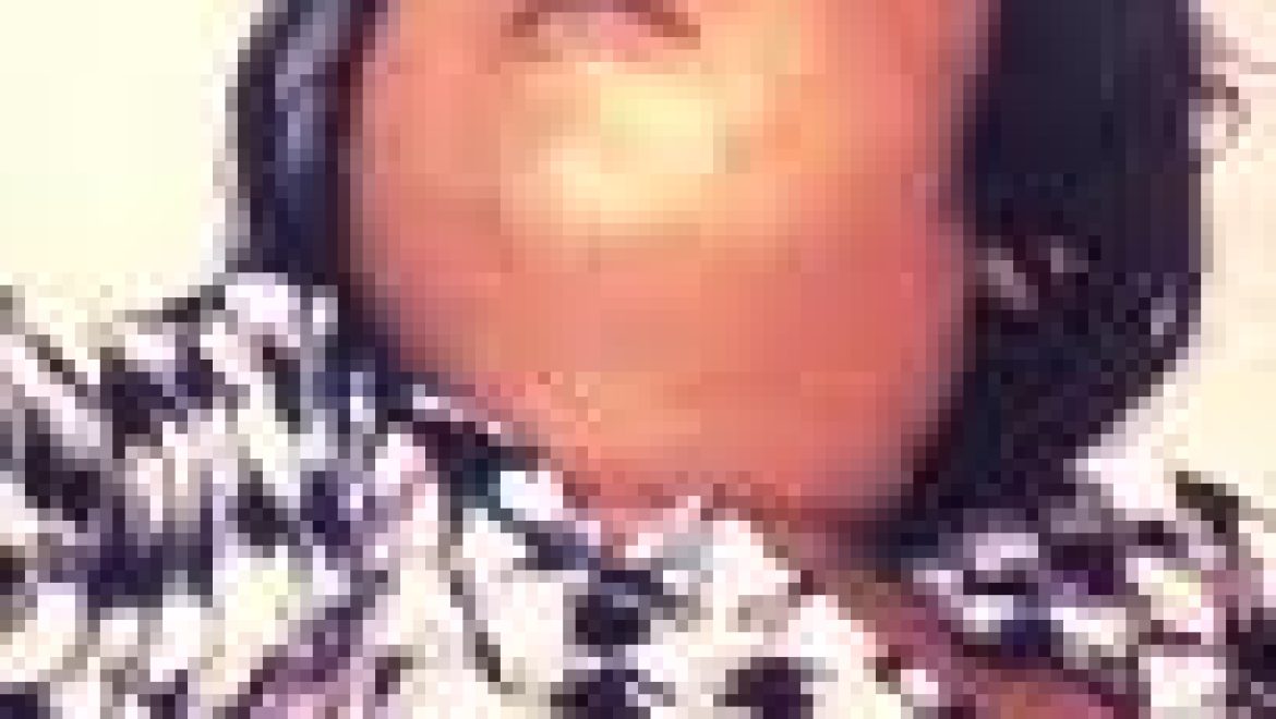 דיפתריה מחלת גרון (קרמת לועזית diphtheria) בלשון התלמוד: אסכרה, סרונכי.