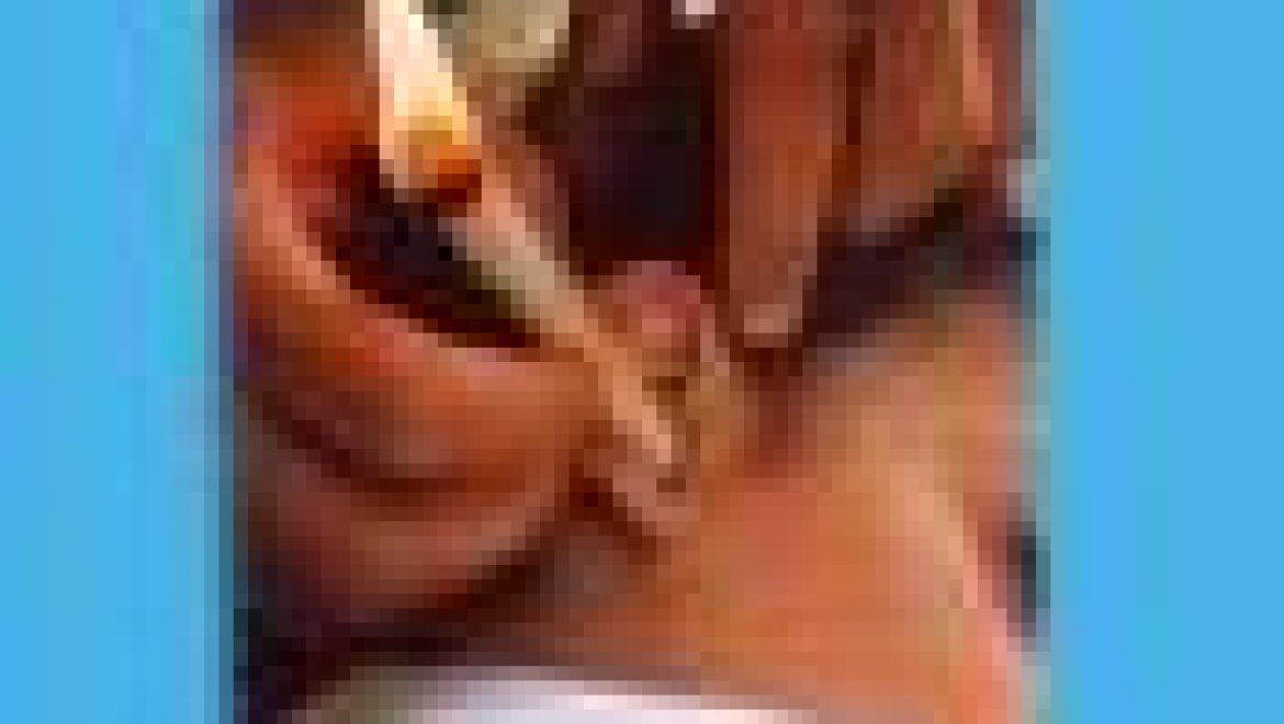 כאבי אוזניים בלשון התלמוד חש באודניה