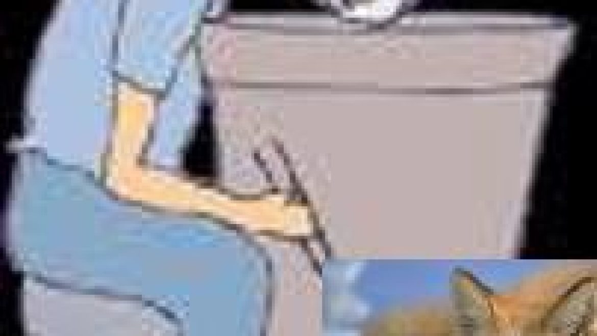 הפרעות שינה