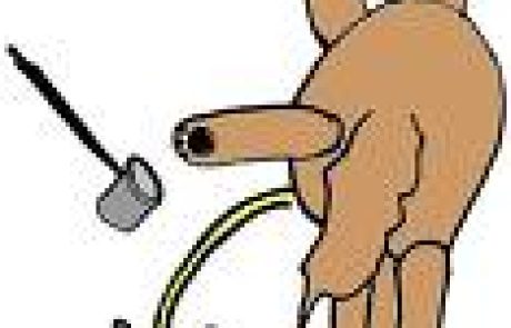 מחלת הצהבת ( Jaundice,) בלשון התלמוד ירקון.