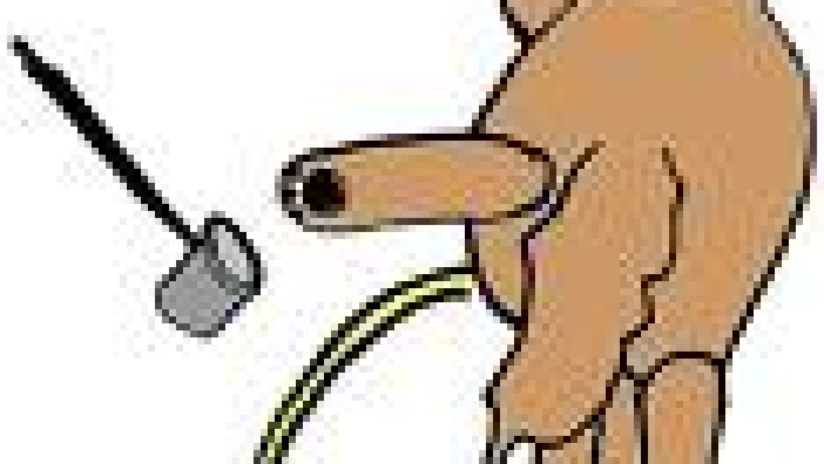 מחלת הצהבת ( Jaundice,) בלשון התלמוד ירקון.